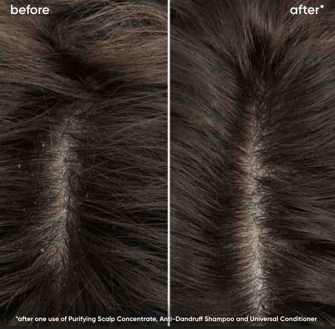 Before and After Image